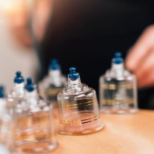 Advanced Cupping : Range of Motion | August 3rd, 2024 - Image 1
